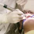 Dicas para prevenir cáries e manter a saúde bucal