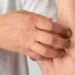 Como saber se tenho alergia ao camarão