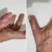 Quais são os cuidados na hora de ir fazer a unha na manicure