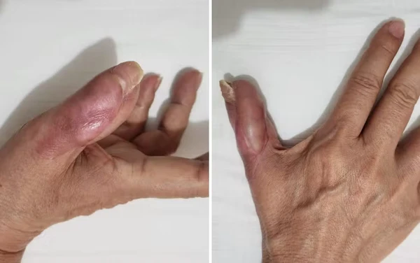 Quais são os cuidados na hora de ir fazer a unha na manicure