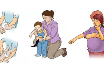 Veja passo a passo para realizar a manobra de Heimlich em você mesmo
