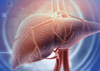Essa é a melhor forma de resolver a gordura no fígado, diz endocrinologista